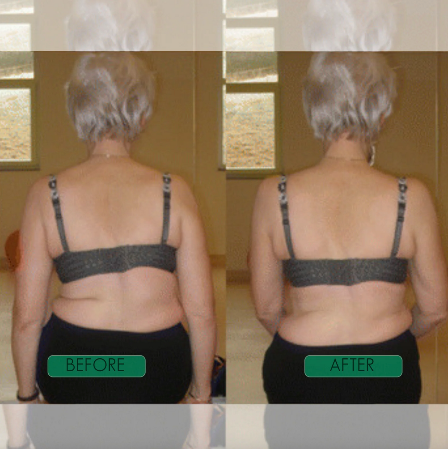 SpineAlign Pro